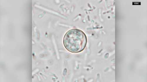 CDC Issues Urgent Health Alert as Cyclosporiasis Outbreak Surges to Over 1,600 Cases Across 34 States