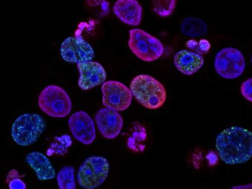 Global Scientists Use 'Custom mRNA Wanted Posters' to Train the Body's Security Guards to Hunt Down Cancer Cells