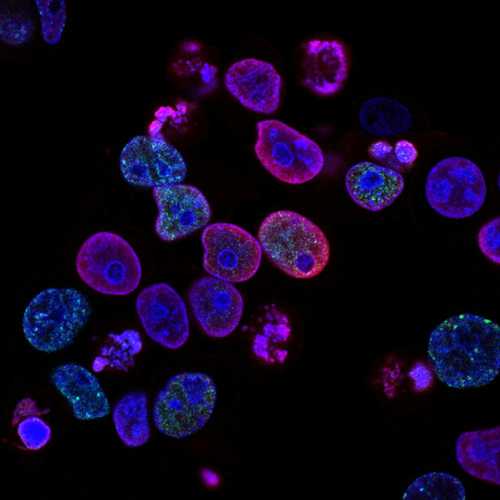 Mayo Clinic Tapestry Study Generates Largest-Ever Exome Database for Personalized Medicine